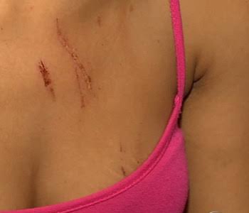 MARIA DA PENHA: Manicure é socorrida para a UPA após ser espancada por marido enciumado 