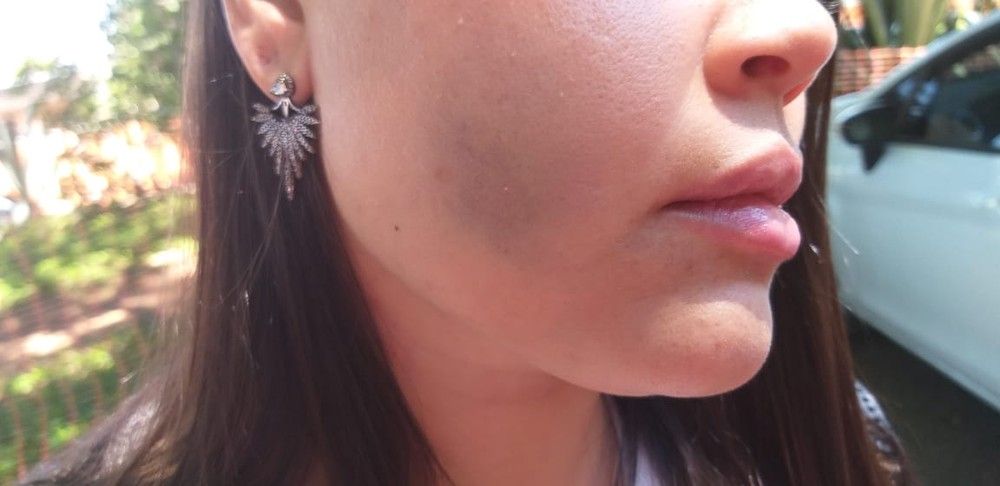 MARIDO VIOLENTO: Mulher é agredida a capacetadas ao ser encontrada bebendo em bar