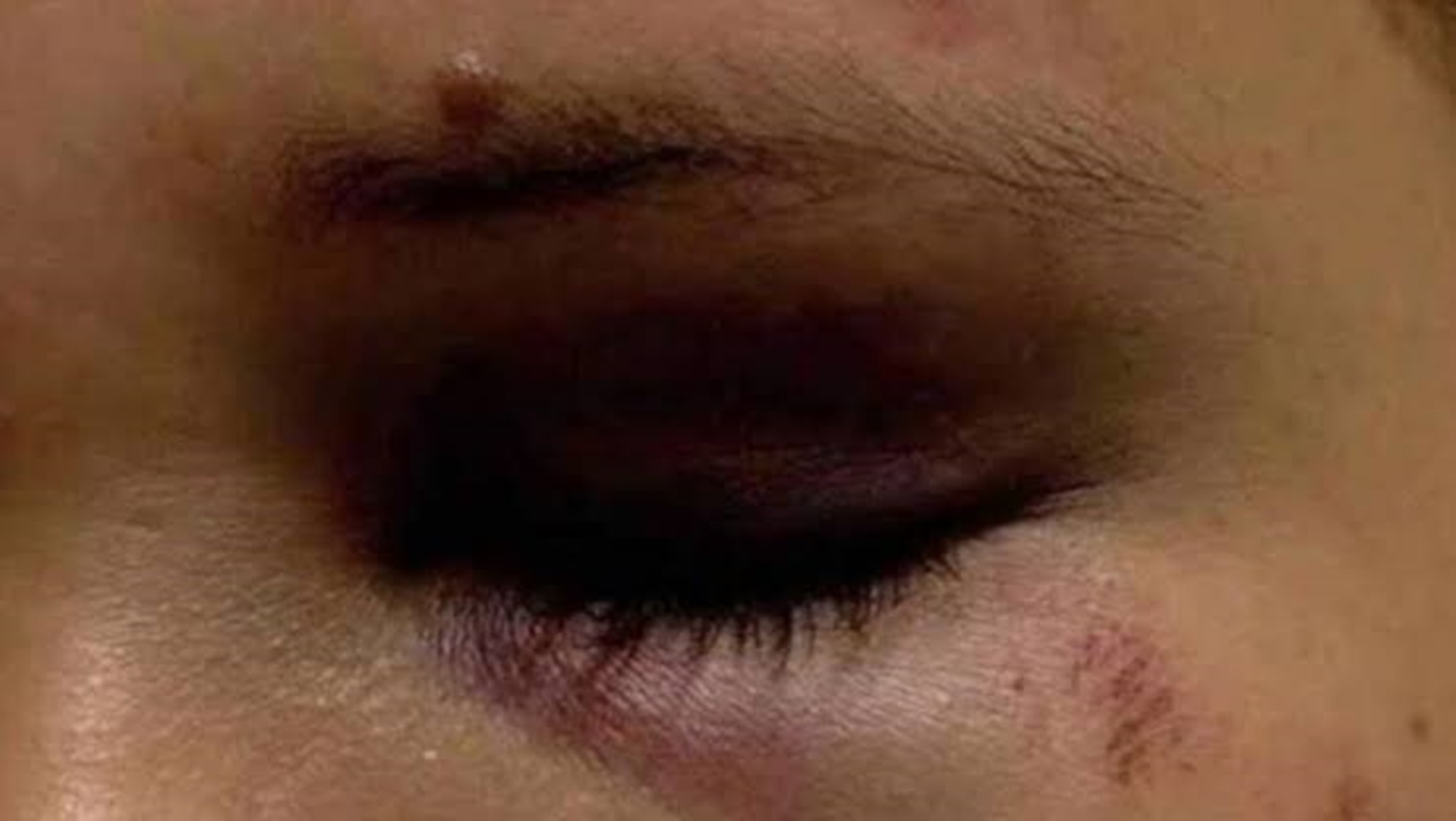 DE NOVO: Filho agride e arrasta mãe pelos cabelos após sair da cadeia 