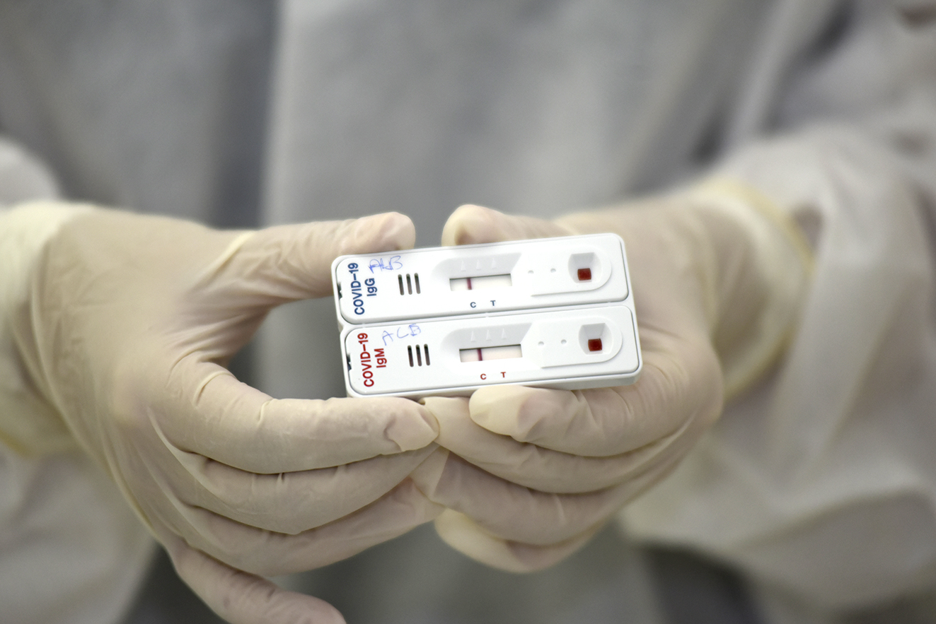 COVID-19: Rondônia tem duas mortes e mais de 1,8 mil casos confirmados em um dia