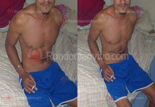 URGENTE: Acusado de tentar tirar a vida da esposa investe contra policiais e leva bala 